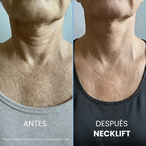 Crema para el cuello Tighten & Lift