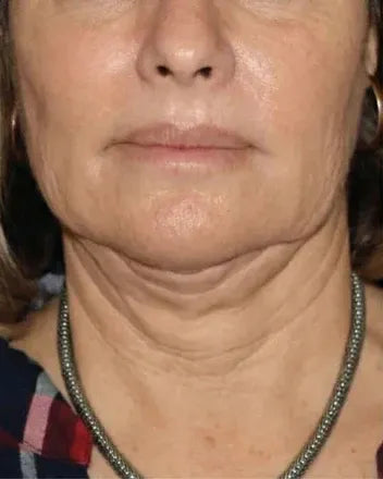 Antes